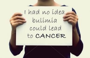 Does bulimia cause cancer? – Binge Code